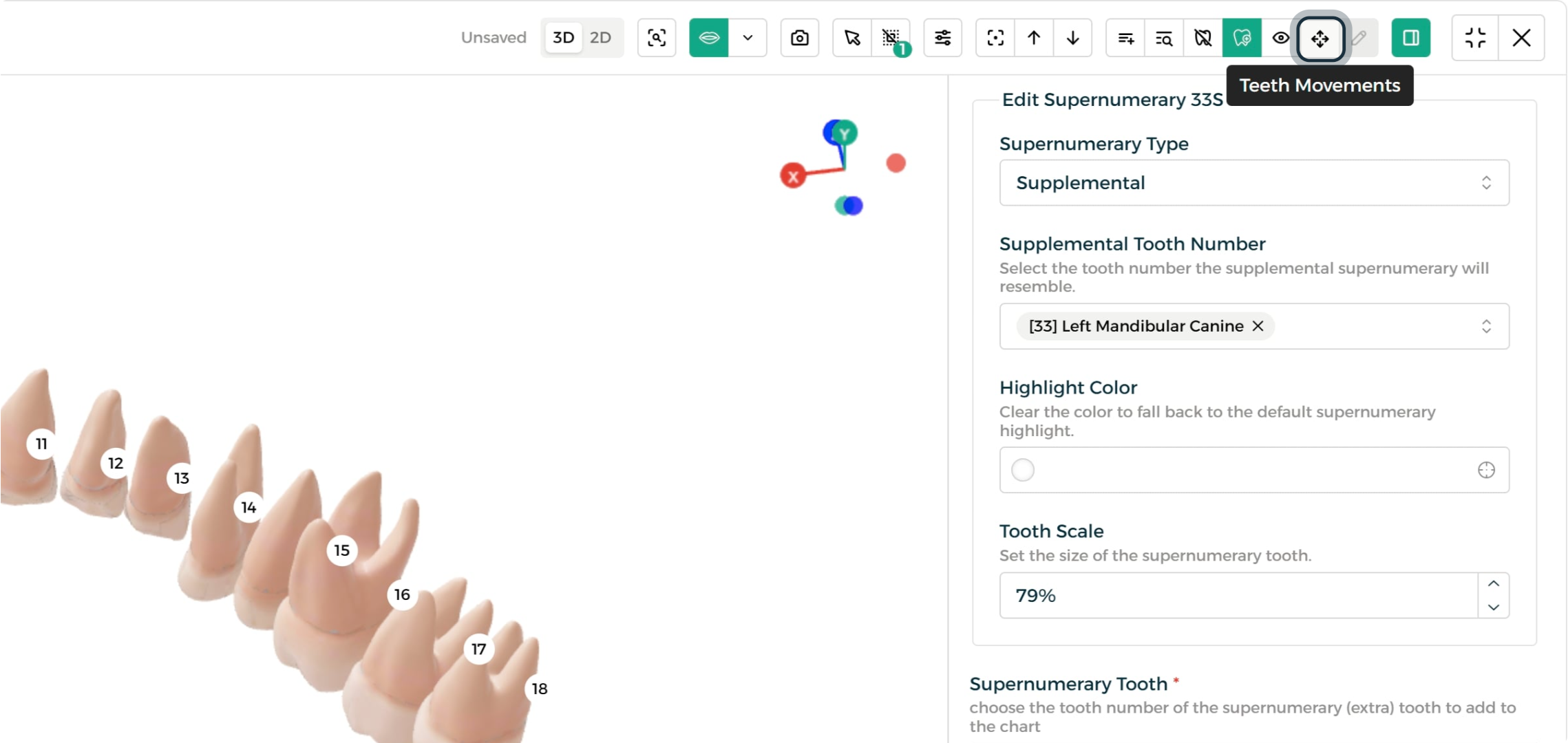 Step 2 - Teeth Movements tab